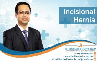 hernia surgery in kolkata