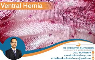 07-10-20-Ventral-Hernia