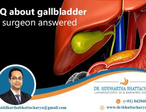 FAQ about gallbladder- a surgeon answered
