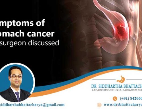Symptoms of stomach cancer- a surgeon discussed.