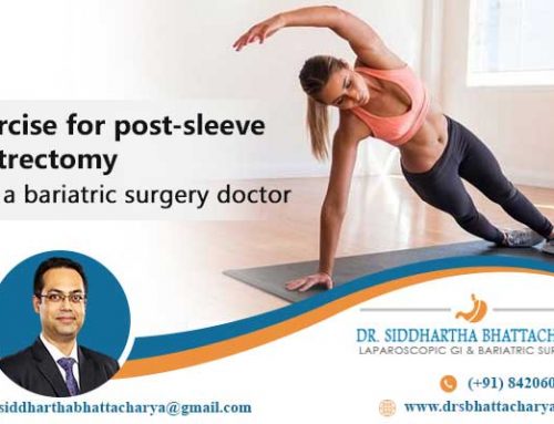 Exercise for post-sleeve gastrectomy- by a bariatric surgery doctor