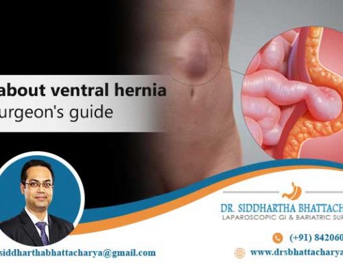 All about ventral hernia-a surgeon’s guide
