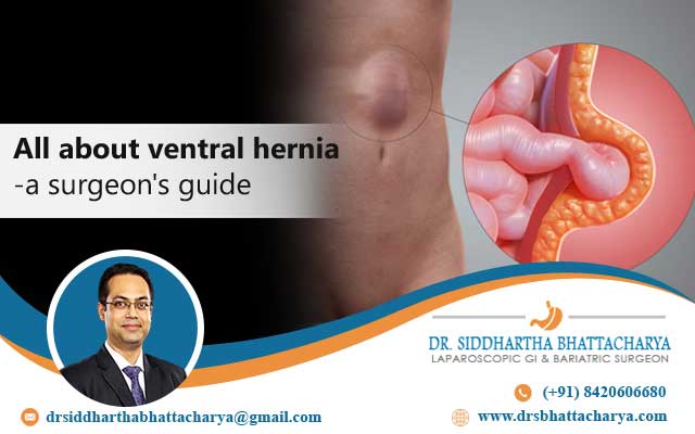 best hernia surgeon in Kolkata
